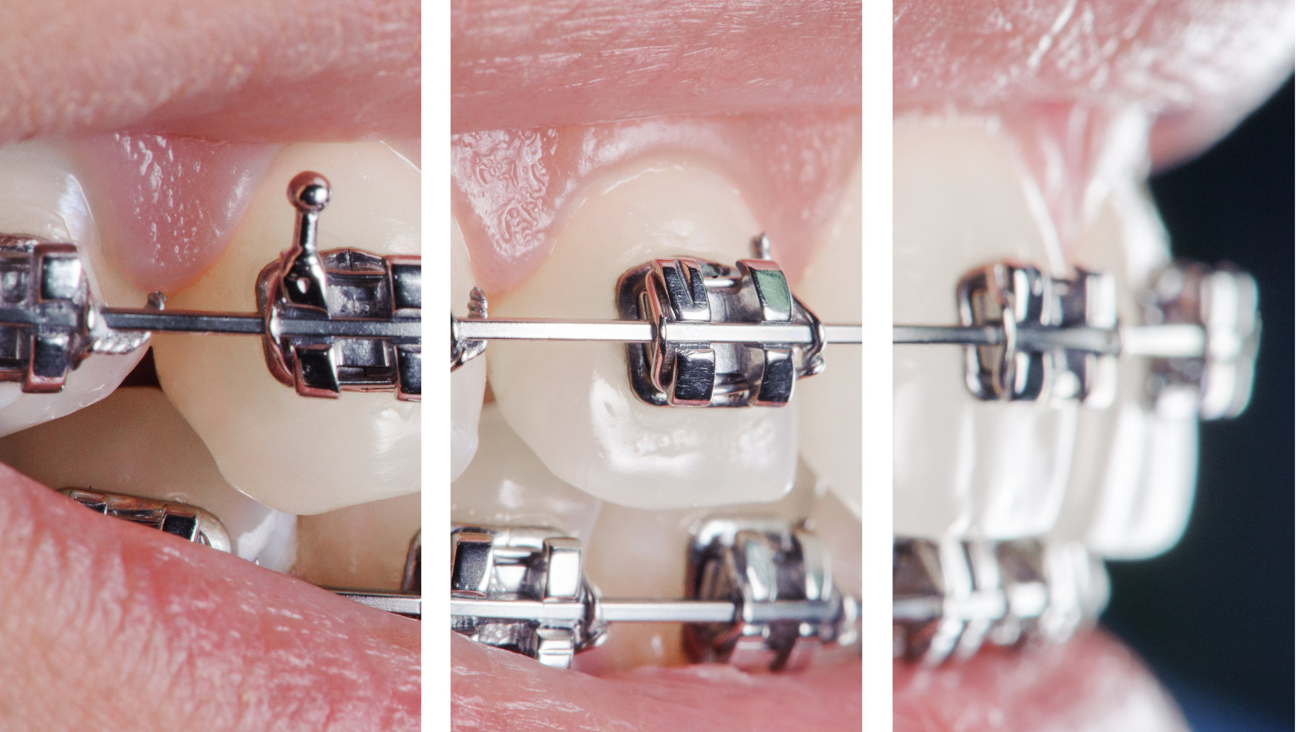 foto ortho